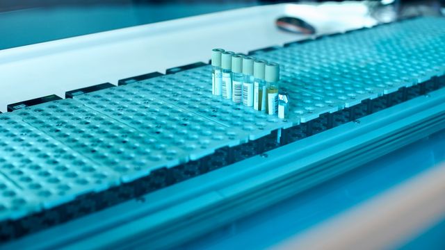 Sample tubes arranged on automated laboratory rack for high-throughput testing. 