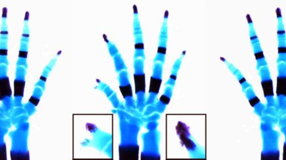 Illustration of limb abnormalities showing mouse paw X-rays with shortened or missing digits.