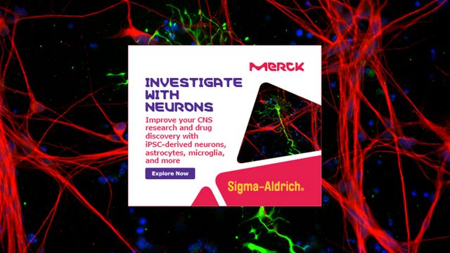 Fluorescent neuron network background with Merck Sigma-Aldrich ad promoting iPSC-derived neurons for CNS research 