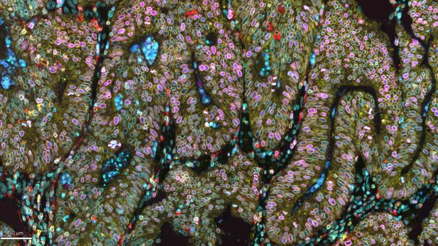 Fluorescent-stained colon cells in mucus layer showing multicolor immune and epithelial cell markers. 