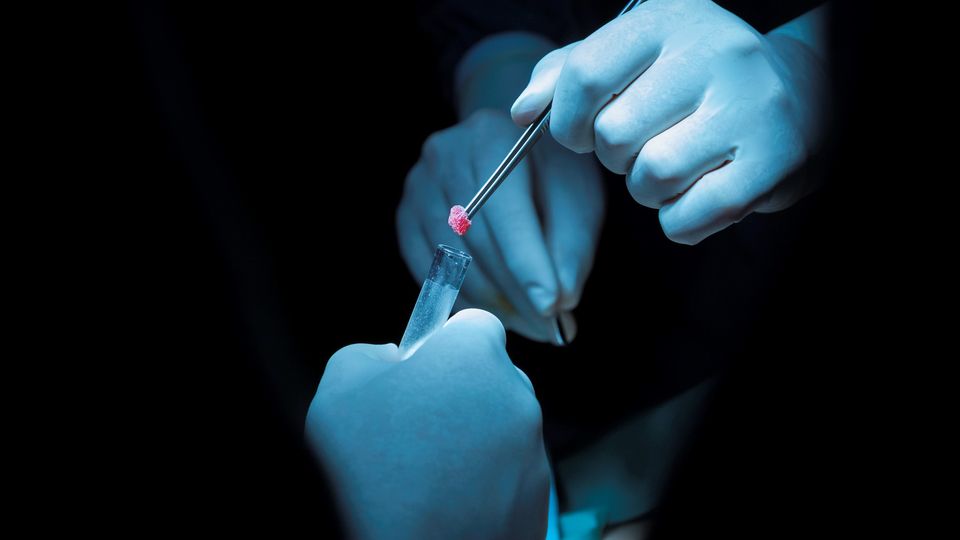 Gloved hands placing tissue sample into test tube, illustrating laboratory tissue analysis.