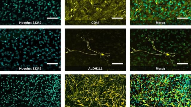Fluorescent brain images showing neural cells and markers in microscopic analysis. 