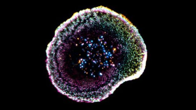 Microscopic view of a cytotoxic T cell showing organized internal cellular structures. 