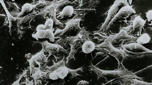 Cancer Protein Uses ATP and ADP To Activate | Technology Networks
