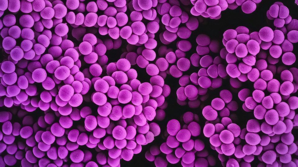 Microscopic view of MRSA bacterial colonies. Each bacteria is spherical in shape and colorized in purple.