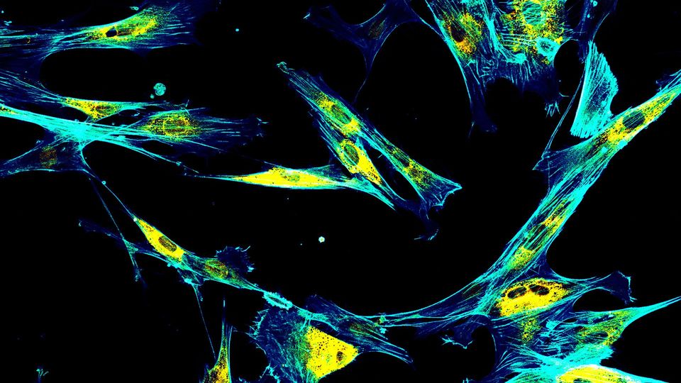 Fluorescence microscopy of cells, with key proteins labeled in yellow, green, and blue.