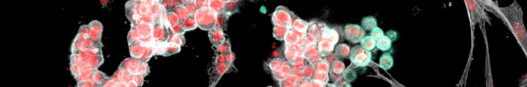 Fluorescent microscopy of 3D culturesorganoids showing clustered cells in red and green 