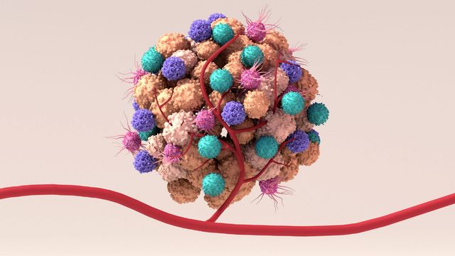 KRAS G12D Drug Shows Promise in Cancer Trial | Technology Networks