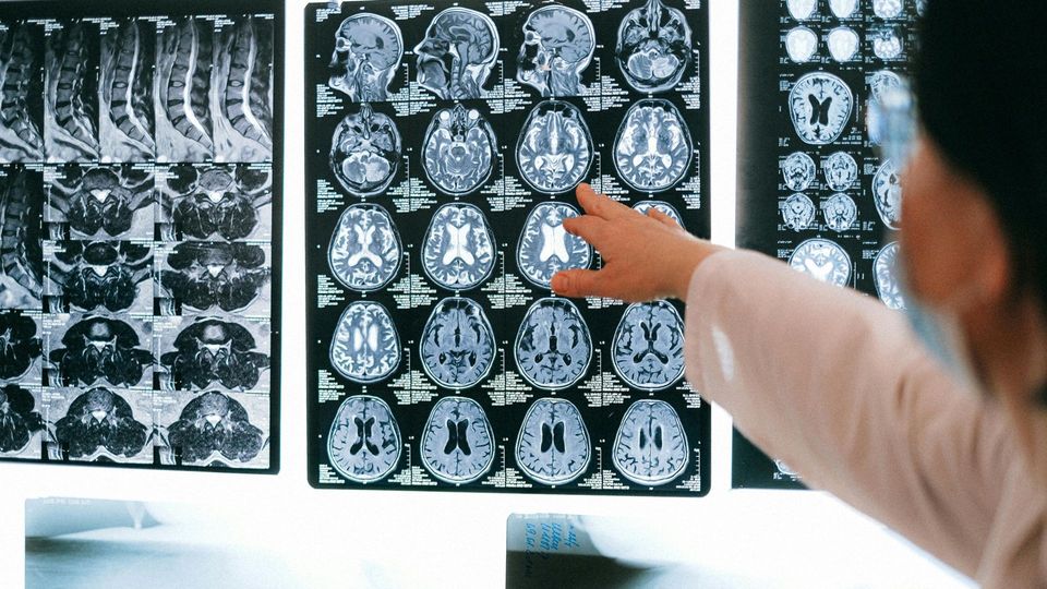 Doctor reviewing MRI brain and spine scans on a medical imaging display.