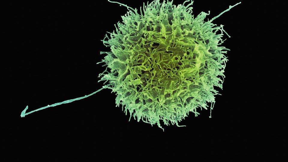 Scanning electron micrograph of a human natural killer cell in green.
