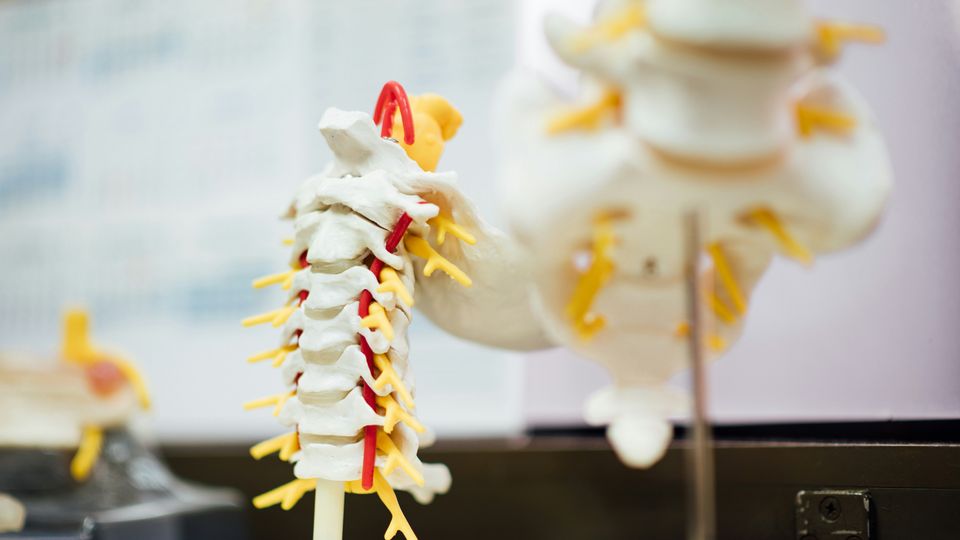 Spinal anatomy model showing individual discs surrounded by vascular structures in red and neural structures in yellow.