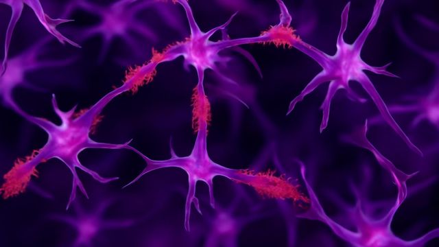 Render of neuronal network in purple, showing bodies of a neurons with dendrites branching off, covered in red plaques. 