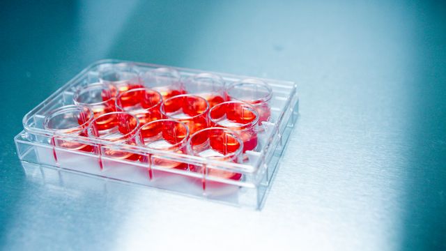 A multi-well plate on a bench containing cell culture used in drug discovery. 
