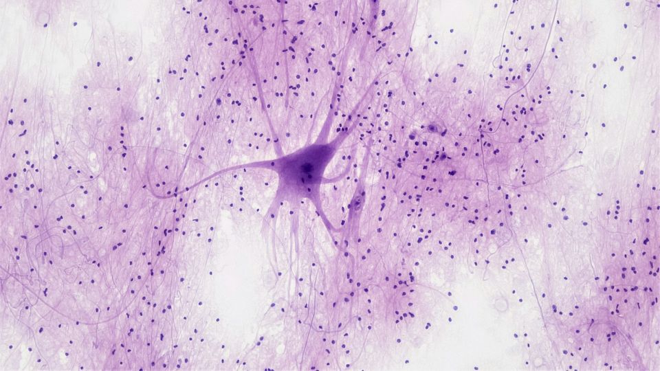 Microscopic view of nervous tissue showing a spinal cord motor neuron.