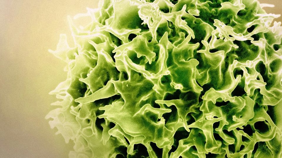 Microscopic view of a green T lymphocyte immune cell with detailed surface structure.