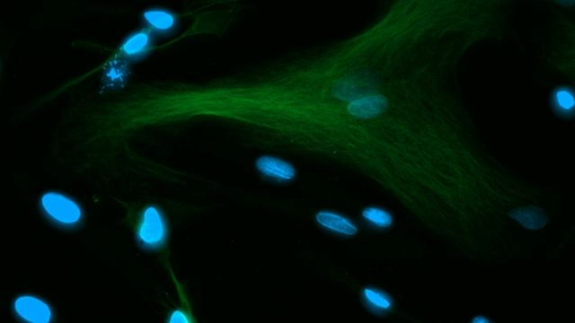 Fluorescent microscopy image of mucosa cells highlighting cellular structure and nuclei. 