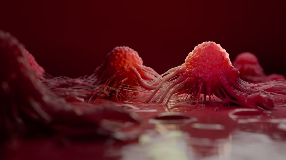 Illustration of red cancer cells with several long projections reaching into the surroundings.