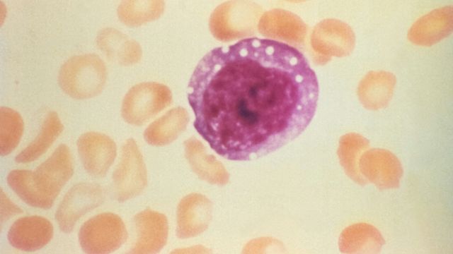Microscopic view of a pink blood cell among red blood cells 