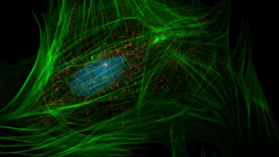 Fluorescent fibroblast cell with visible mitochondria and cytoskeleton under a microscope.