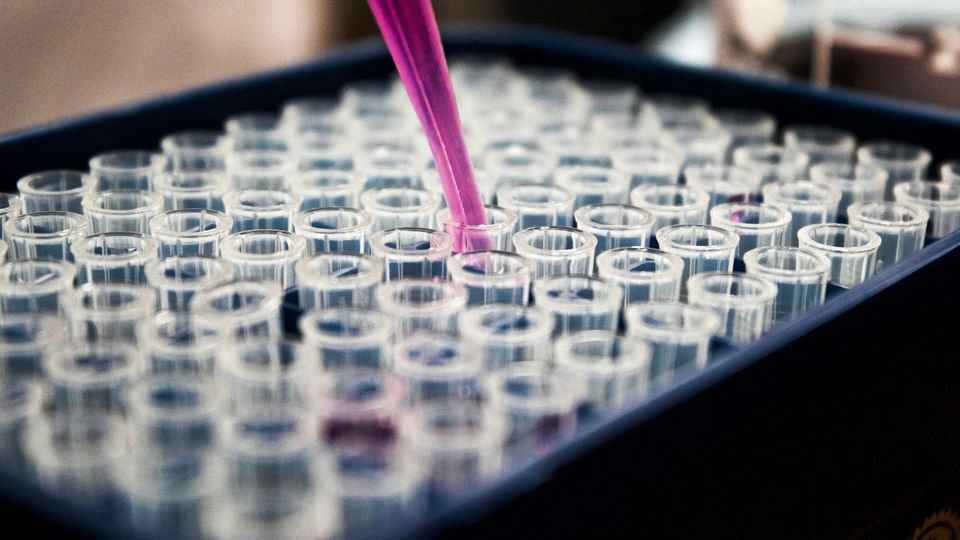 Pipette dispensing liquid into sample tubes during laboratory testing.
