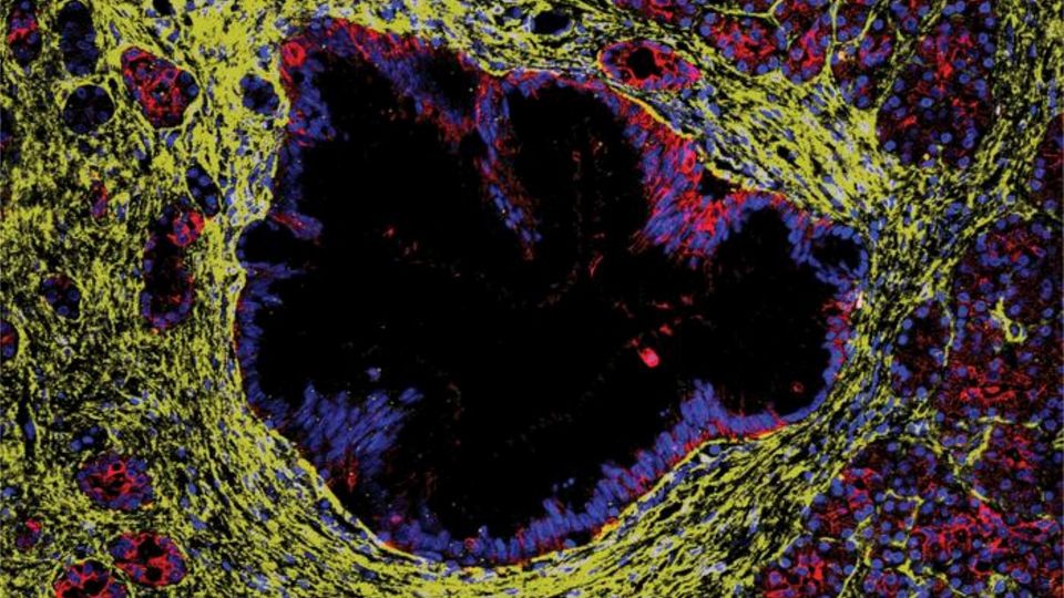 Microscopic image of human pancreas tissue showing cellular structure.