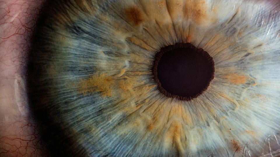 Novel Eye Drops Reduced Inflammation in Dry Eye Disease | Technology ...