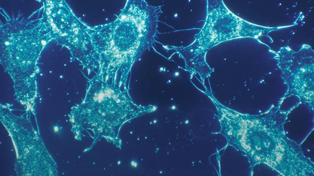 Microscopic view of connective tissue cells with glowing structures. 
