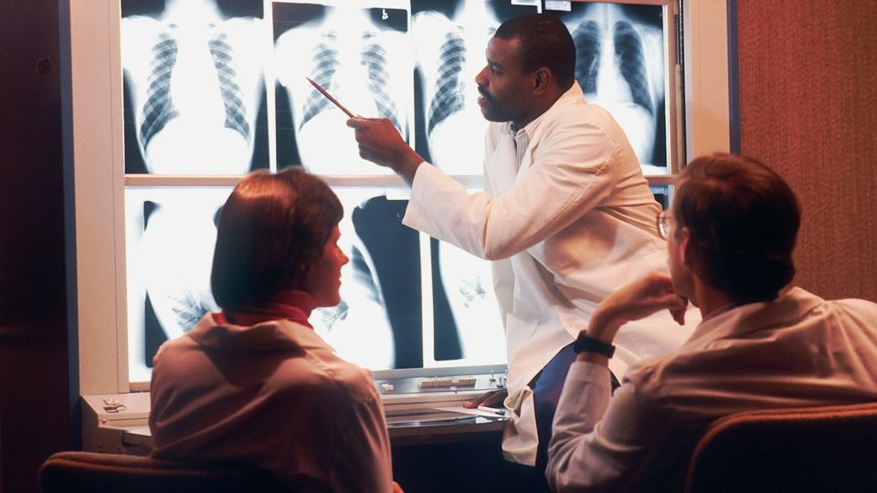 Doctor pointing at chest X-rays while discussing medical imaging results with healthcare colleagues.