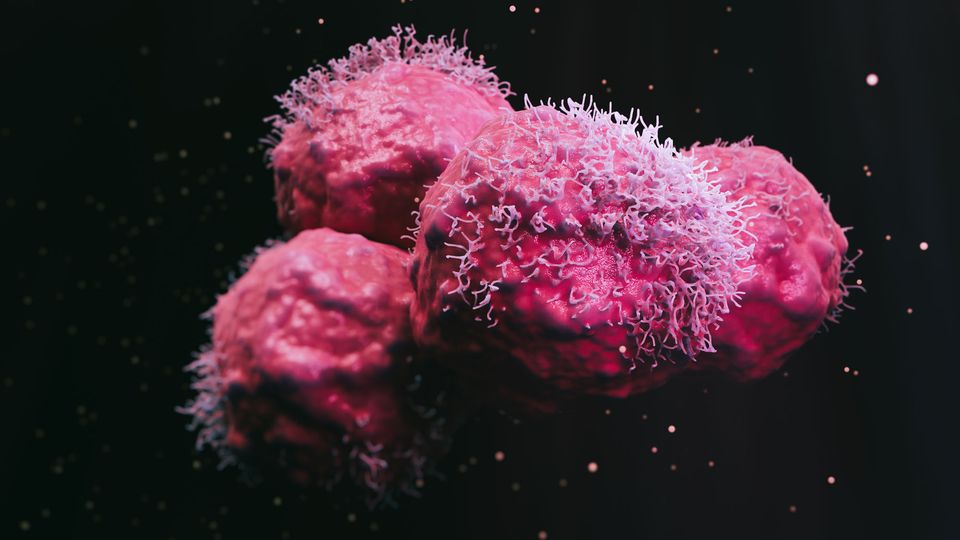 Illustration of four cancer cells. The cells are pink with hair-like projections and are floating on a black background.