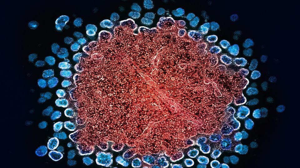 Colorized transmission electron micrograph of numerous HIV-1 virus particles, in blue, replicating from T cell, in red.