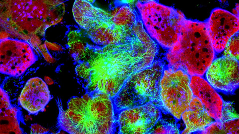 Fluorescent cancer cells. The cells are pink, green, and blue and are arranged on a black background.