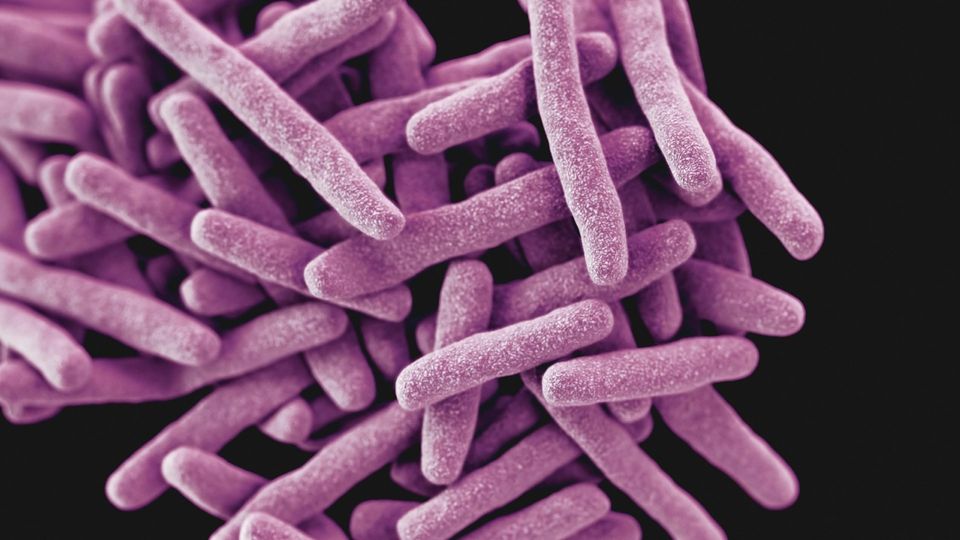 Pink rod-shaped bacteria under a microscope.