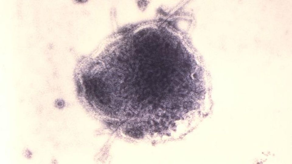 Transmission electron micrograph of a paramyxovirus measles virus particle showing its spherical structure.