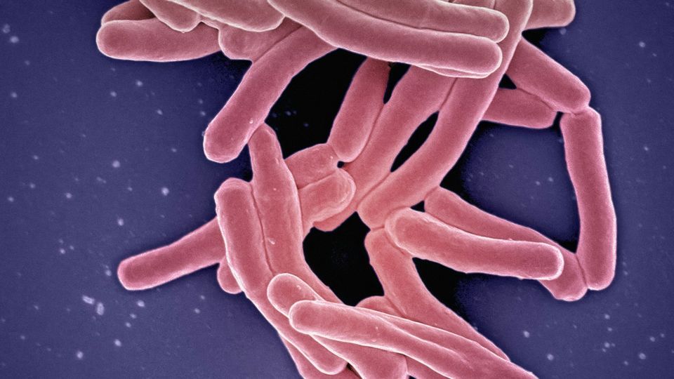 Scanning electron micrograph showing a cluster of rod-shaped Mycobacterium tuberculosis bacteria in pink.