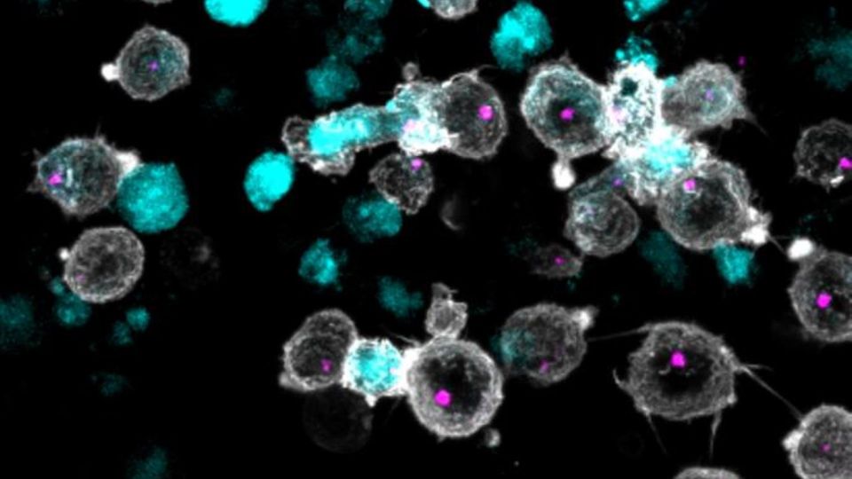 Microscopic view of CAR T cells targeting cancer cells in immunotherapy treatment.