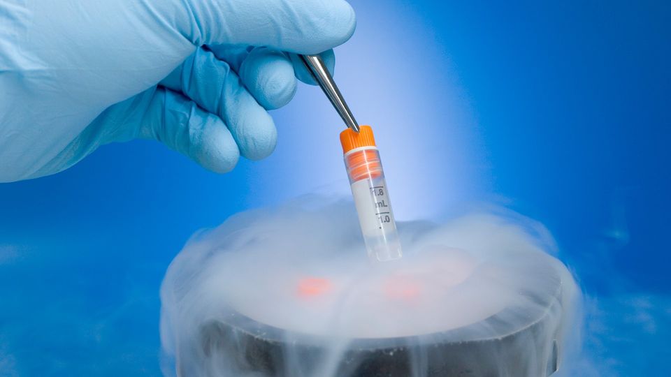 A gloved hand uses tweezers to retrieve a sample from a cryopreservation unit.