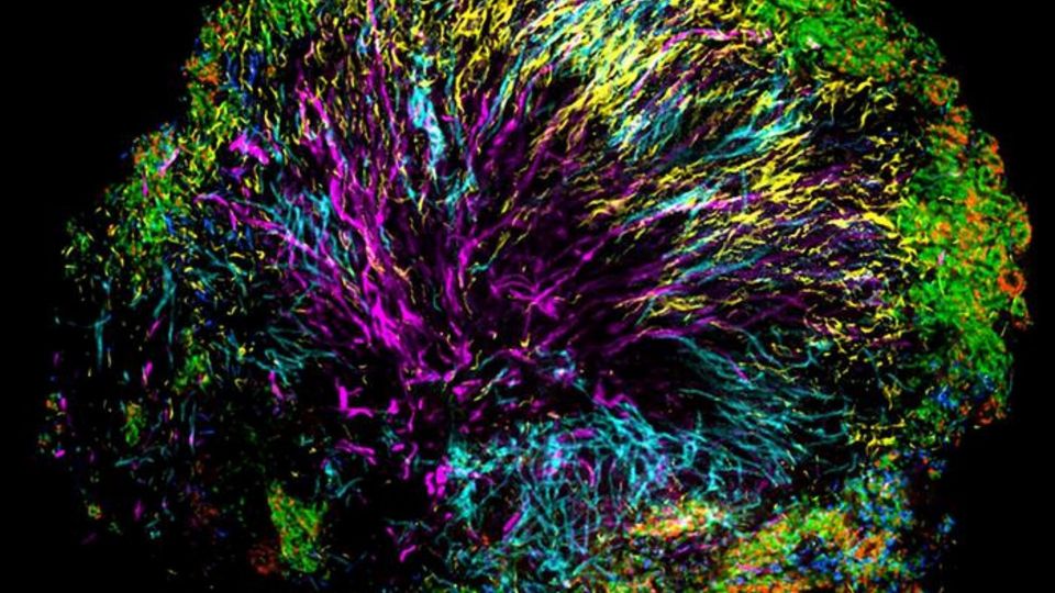 Microscopic image of bacteria in dental plaque.