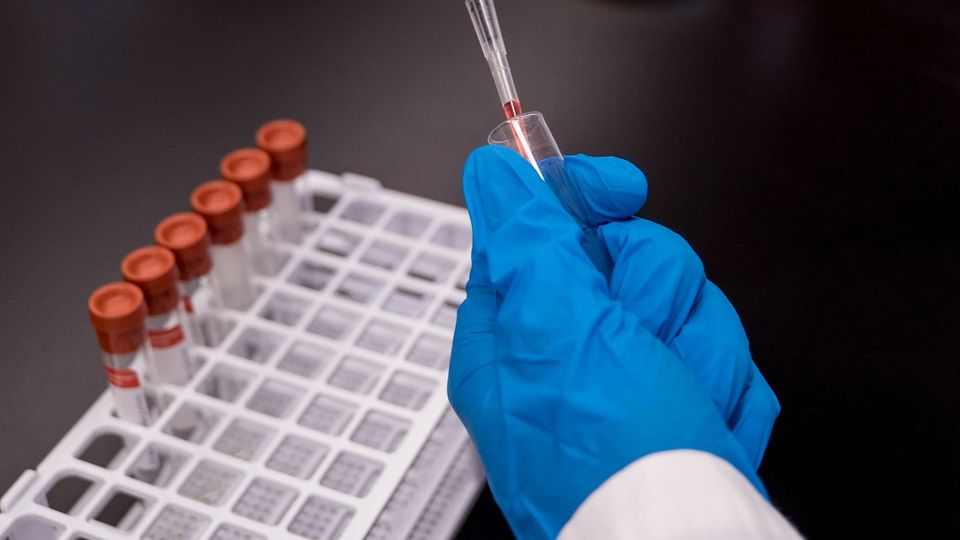 Gloved laboratory technician transferring a blood sample into a test tube for medical testing.