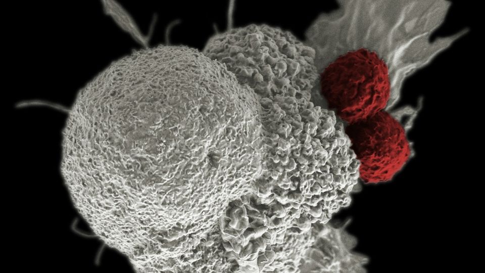 Microscopic image of immune cells interacting with cancer cells in tumor-targeting research.