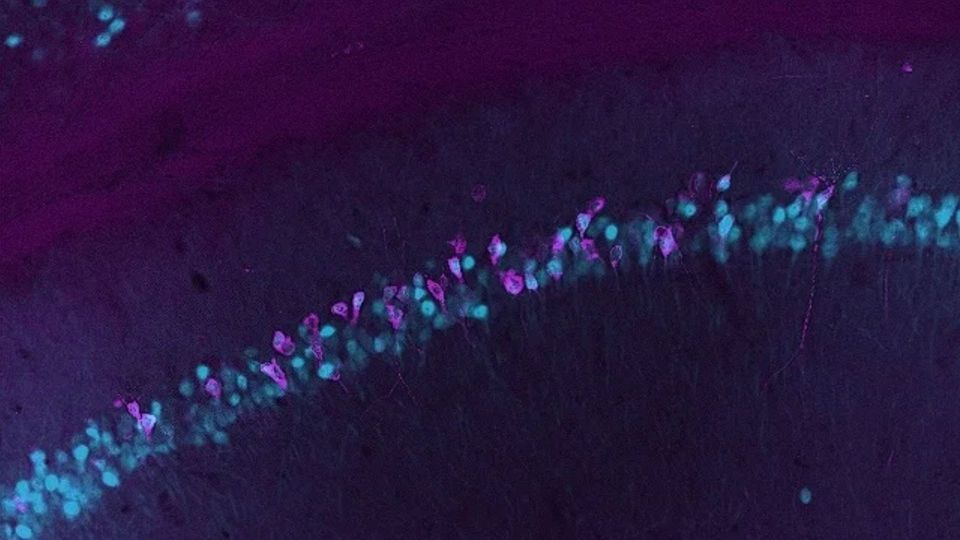 Fluorescent microscopy image showing RNA activity in neuronal tissue.