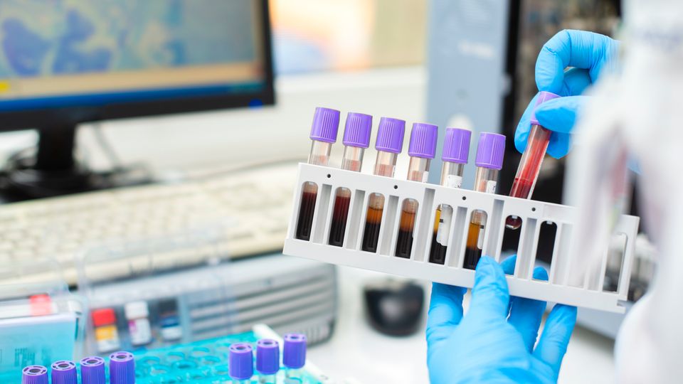 Gloved hands holding a test tube rack with several test tubes containing blood samples. Behind is a computer monitor and keyboard.