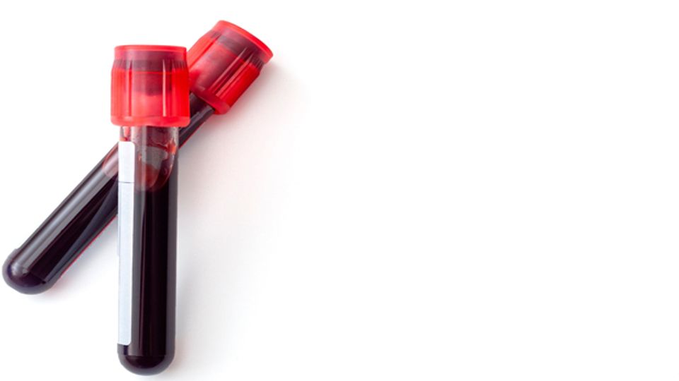 Two tubes containing blood samples laying on a white background.