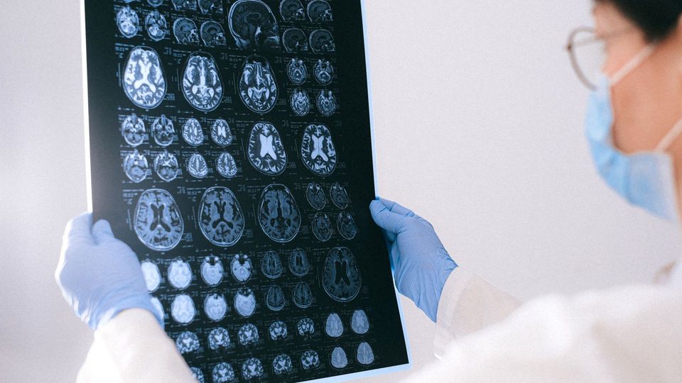 Healthcare professional reviewing brain scan images on a medical imaging film.