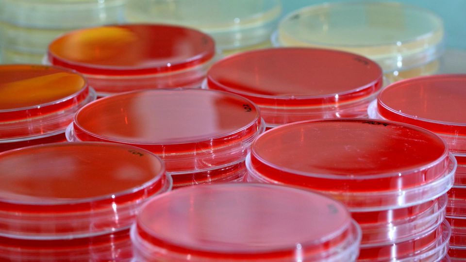 Red-filled petri dishes stacked in a laboratory.