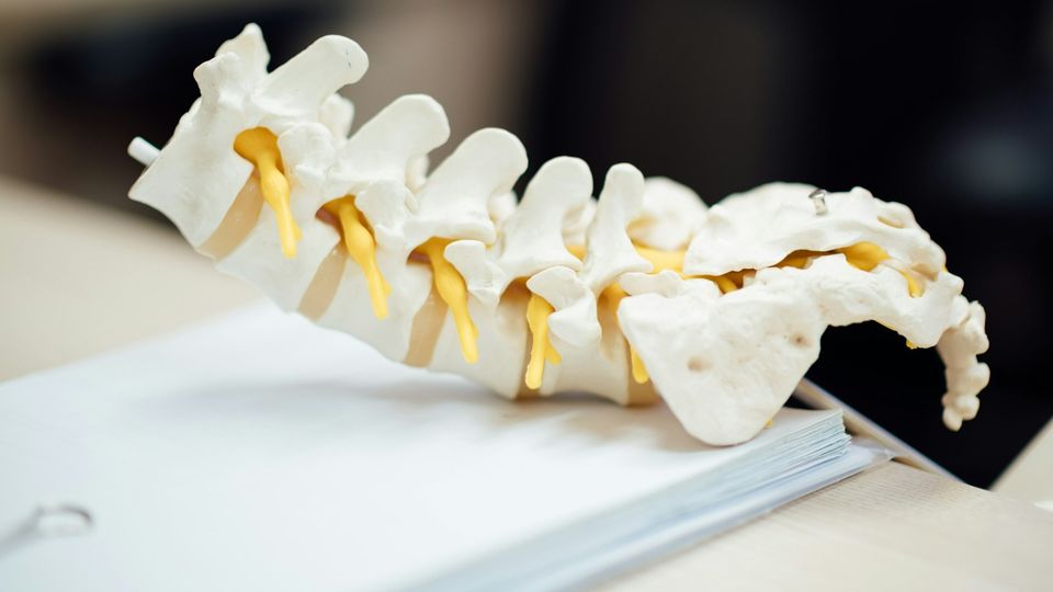 Anatomical vertebrae model showing spinal column structure with spinal nerves in yellow and vertebral discs in white.