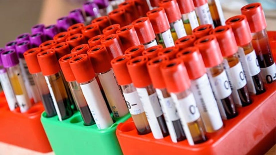 Blood sample tubes with red and purple caps arranged in laboratory racks.