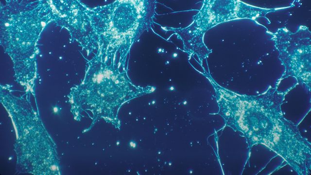 Fluorescent microscopy image of connective tissue cells showing cellular networks and structural fibers. 