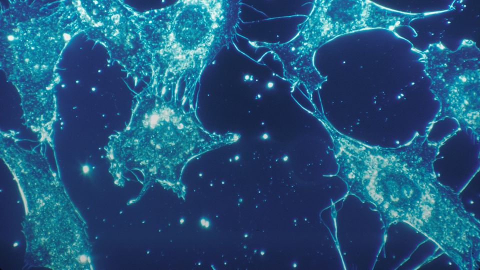 Fluorescent microscopy image of connective tissue cells showing cellular networks and structural fibers.