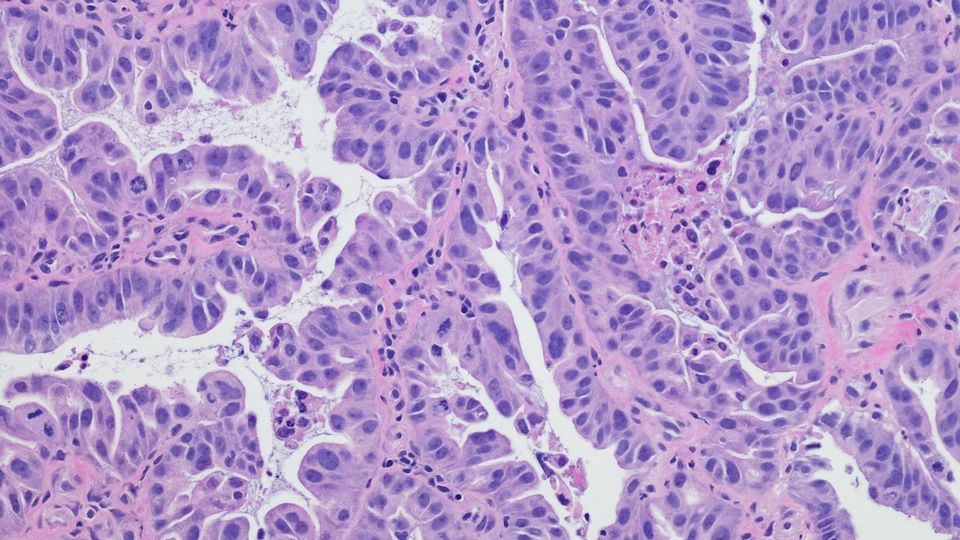 Histology slide showing human cells. The cells are light and dark puruple.