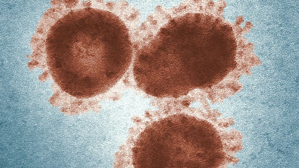 Infectious bronchitis virus particles under an electron microscope.